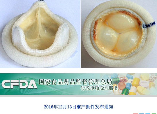 国家食品药品监督管理总局：阜外医院牵头进行注册研究的首个国产TAVR瓣膜获批上市